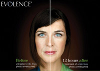 Fort Lauderdale Evolence Before and After